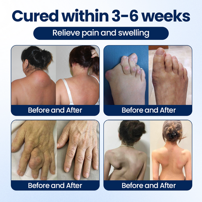 Timilk® ArthriNAD+ Pro Advanced Joint Recovery Cream.