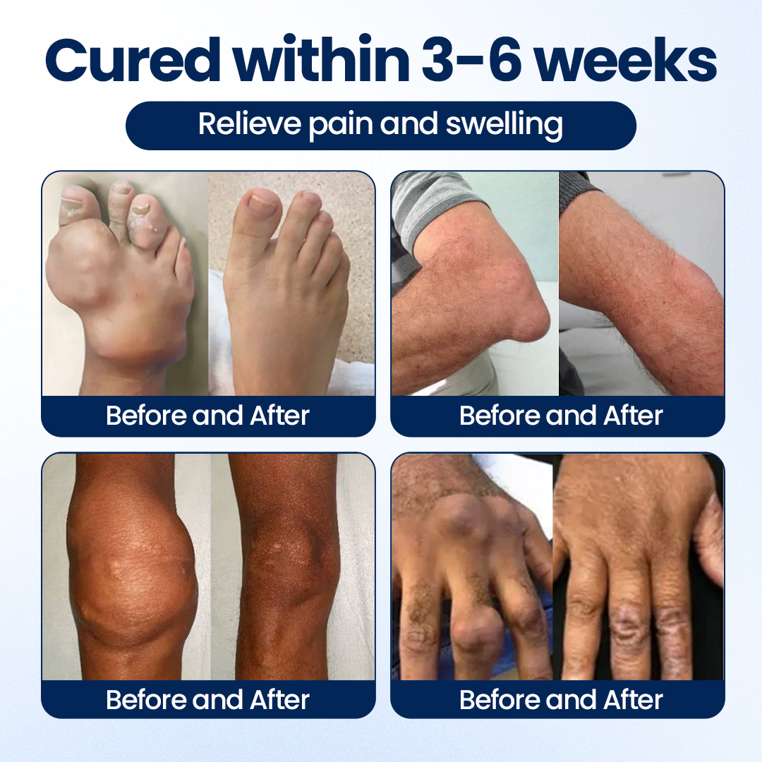 Timilk® ArthriNAD+ Pro Advanced Joint Recovery Cream.