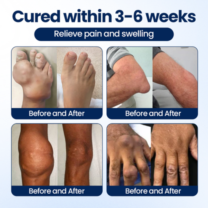 Timilk® ArthriNAD+ Pro Advanced Joint Recovery Cream.