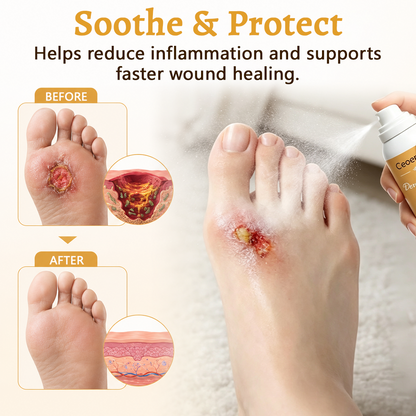 Ceoerty® DermaVeil Foot Defense Mist
