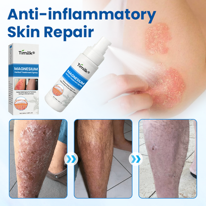 Timilk® Magnesium Herbal Treatment Spray.