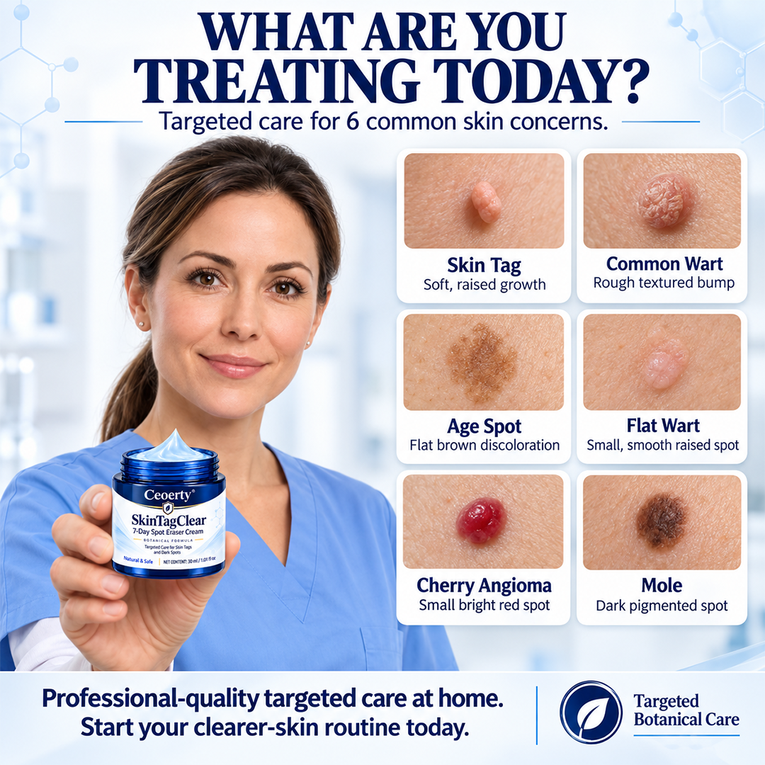 Ceoerty® SkinTagClear 7-Day Spot Eraser Cream