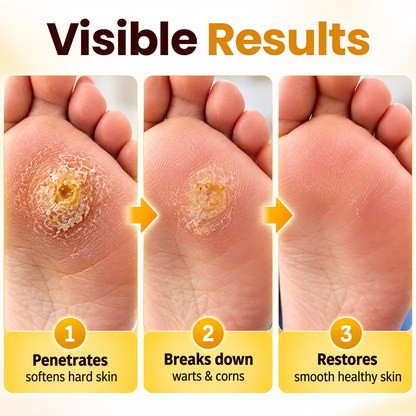 Biancat® BeeClear Wart & Corn Renewal Cream.