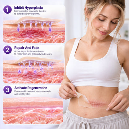 Biancat® ScarMatrix Hyaluronic Acid Nano Microneedle Repair Tape