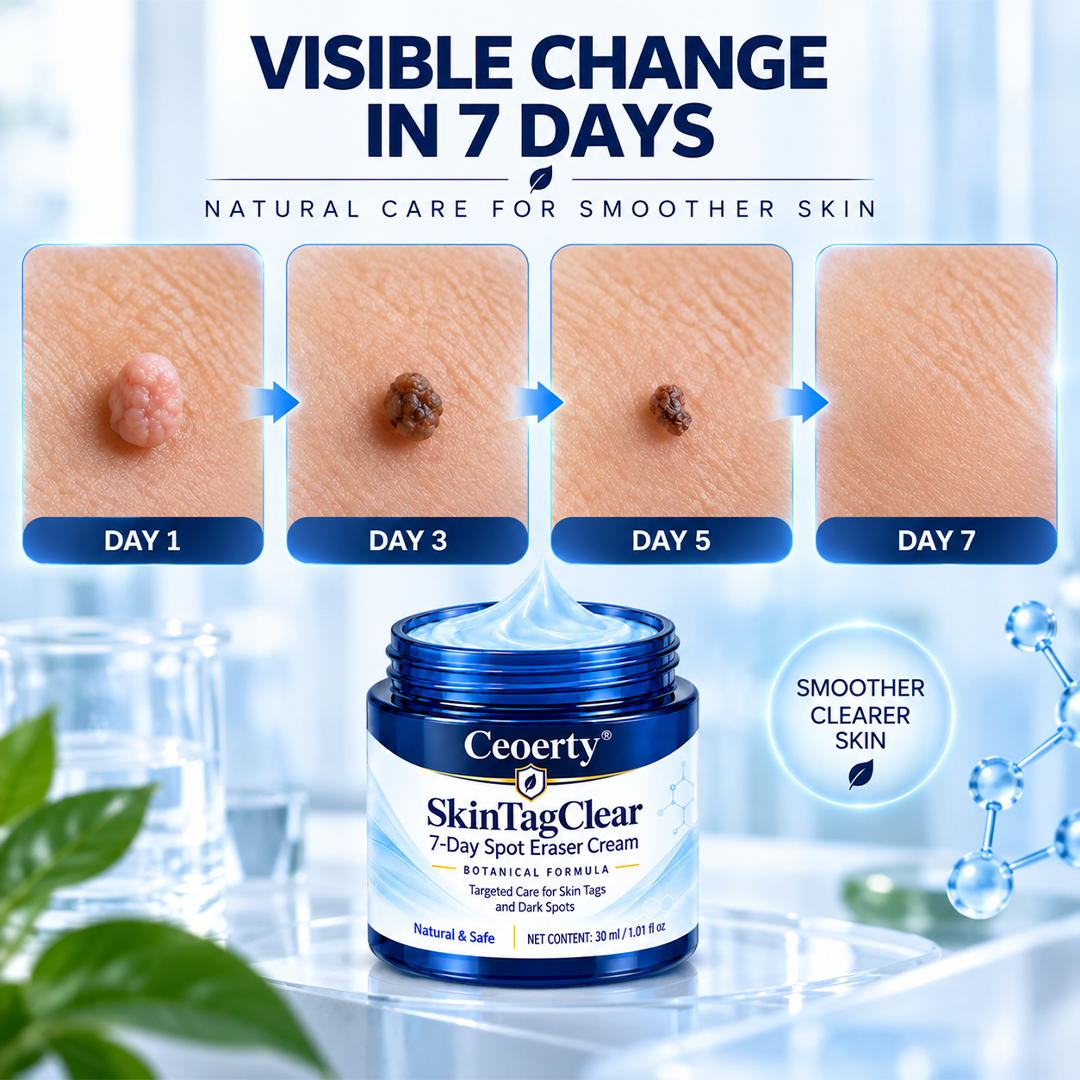 Ceoerty® SkinTagClear 7-Day Spot Eraser Cream