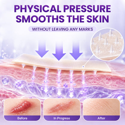 Biancat® ScarMatrix Hyaluronic Acid Nano Microneedle Repair Tape