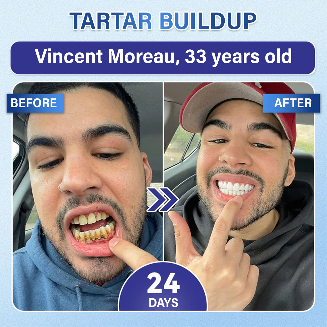 Ceoerty® Tooth & Gum Repair Fast-Dissolving Microneedle Patch✨ (𝟓-𝐢𝐧-𝟏 💎 𝐑𝐞𝐛𝐮𝐢𝐥𝐝 𝐄𝐧𝐚𝐦𝐞𝐥 & 𝐃𝐞𝐧𝐭𝐢𝐧 • 𝐒𝐭𝐫𝐞𝐧𝐠𝐭𝐡𝐞𝐧 𝐆𝐮𝐦𝐬 • 𝐄𝐫𝐚𝐝𝐢𝐜𝐚𝐭𝐞 𝐓𝐚𝐫𝐭𝐚𝐫 & 𝐎𝐝𝐨𝐫 • 𝐖𝐡𝐢𝐭𝐞𝐧𝐢𝐧𝐠 • 𝐒𝐭𝐨𝐩 𝐓𝐨𝐨𝐭𝐡 𝐒𝐞𝐧𝐬𝐢𝐭𝐢𝐯𝐢𝐭𝐲)