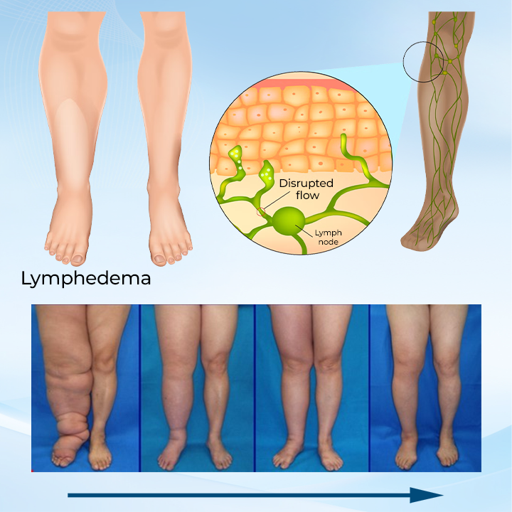 Timilk® LymphoEase Magnesium PCA Roll-On Relief Cream.