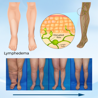 Timilk® LymphoEase Magnesium PCA Roll-On Relief Cream.