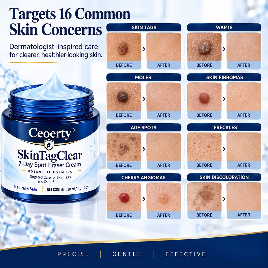 Ceoerty® SkinTagClear 7-Day Spot Eraser Cream