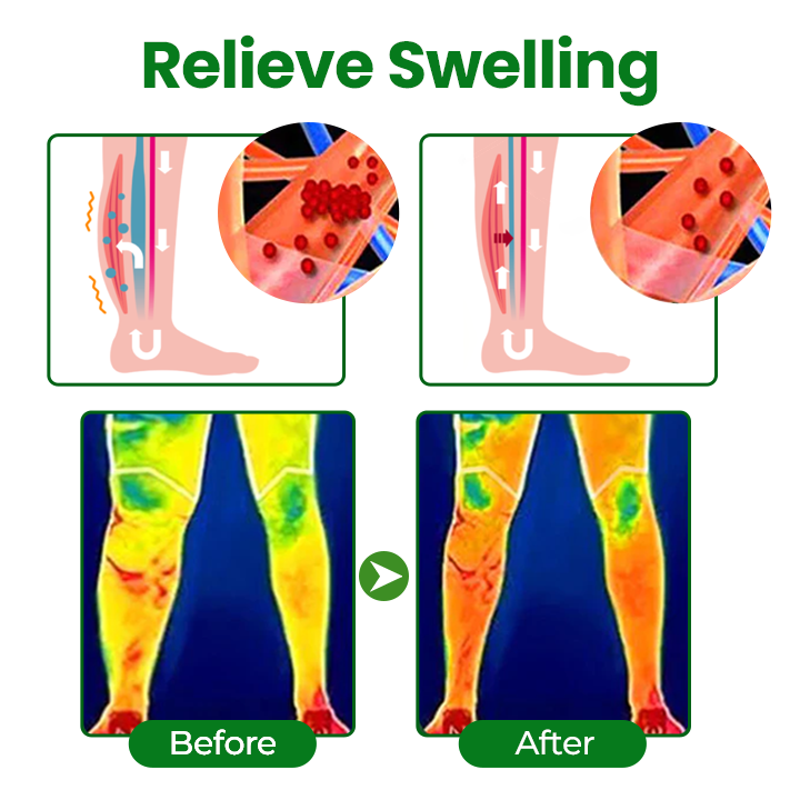 Timilk® VenoLift Leg Relief Spray.
