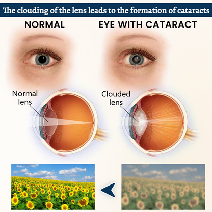 Ceoerty® OptiFusion Vision Support Eye Patch.