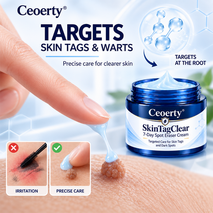Ceoerty® SkinTagClear 7-Day Spot Eraser Cream