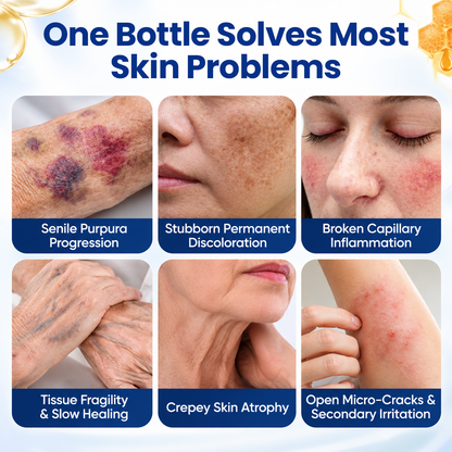 Timilk® VenoRescue Bee Venom Bruise & Skin Recovery Spray.
