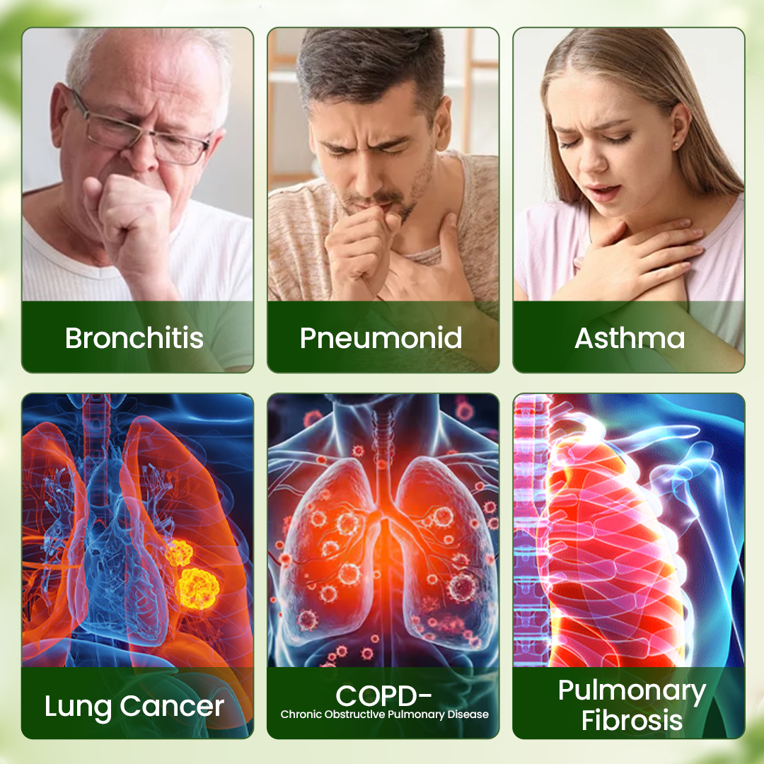 🍀 Timilk® BreatheWell Herbal Propolis Lung Cleanse Spray（👨‍⚕️Directly acts on COPD, asthma, chronic bronchitis (CB), respiratory infections, lung cancer, sinusitis, and other conditions🫁)