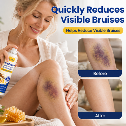 Timilk® VenoRescue Bee Venom Bruise & Skin Recovery Spray.
