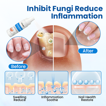 Timilk® Magnesium Herbal Treatment Spray.