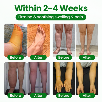 Timilk® VenoLift Leg Relief Spray.