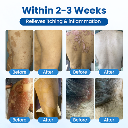 Timilk® Magnesium Herbal Treatment Spray.