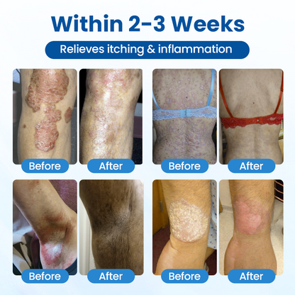 Timilk® Magnesium Herbal Treatment Spray.