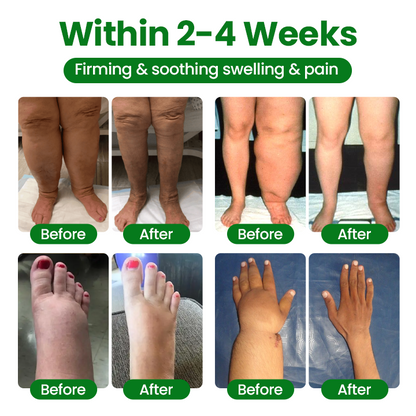 Timilk® VenoLift Leg Relief Spray.