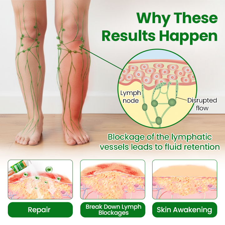 Timilk® VenoLift Leg Relief Spray.