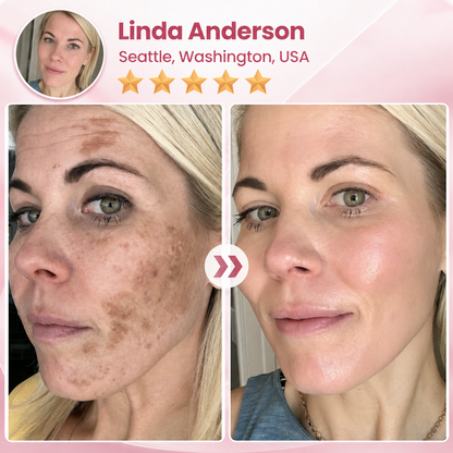 Biancat® NADCell Renew Advanced NAD+ Peptide Serum
