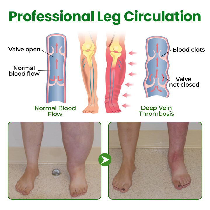 Timilk® VenoLift Leg Relief Spray.