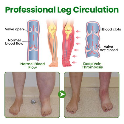 Timilk® VenoLift Leg Relief Spray.