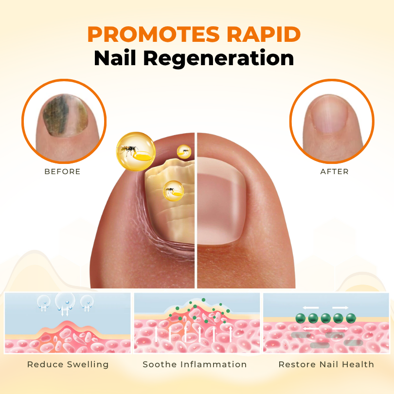 Timilk® NailRevive Bee Venom Anti-fungi Solution.