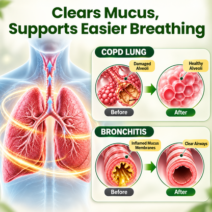 🍀 Timilk® BreatheWell Herbal Propolis Lung Cleanse Spray（👨‍⚕️Directly acts on COPD, asthma, chronic bronchitis (CB), respiratory infections, lung cancer, sinusitis, and other conditions🫁)