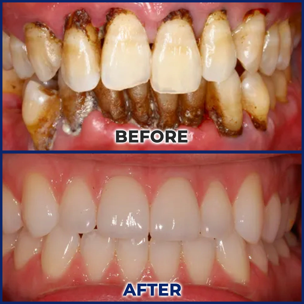 Biancat® BeeTakt Oral Repair Solution