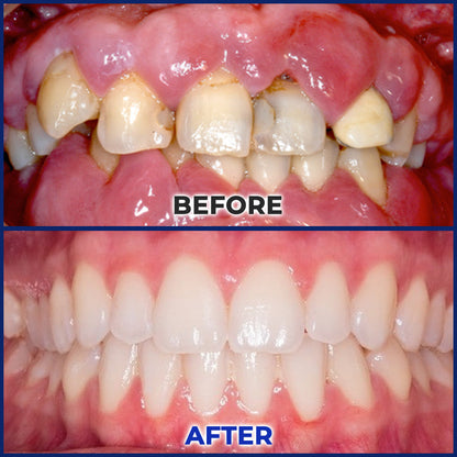 Biancat® BeeTakt Oral Repair Solution