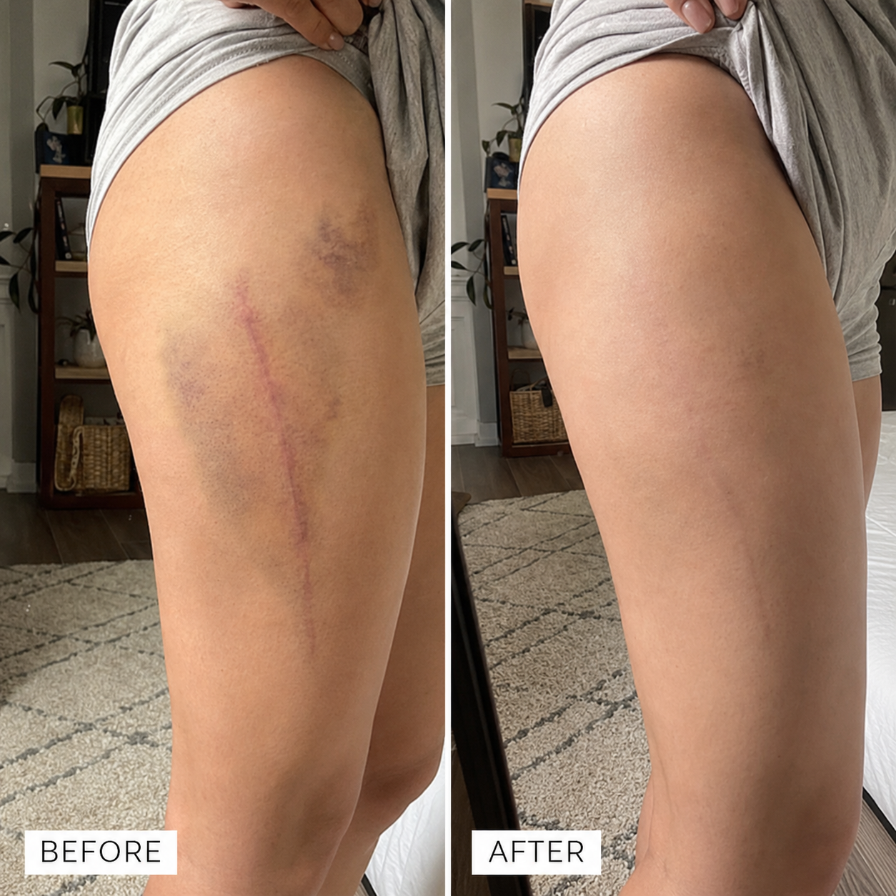 Timilk® BruiseFade Pro Skin Repair Cream