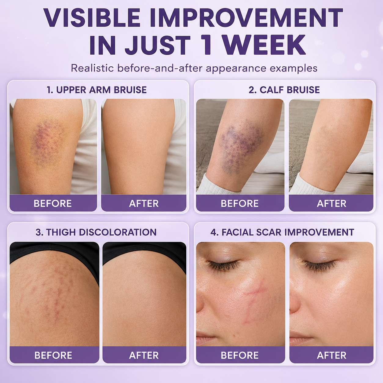 Timilk® BruiseFade Pro Skin Repair Cream