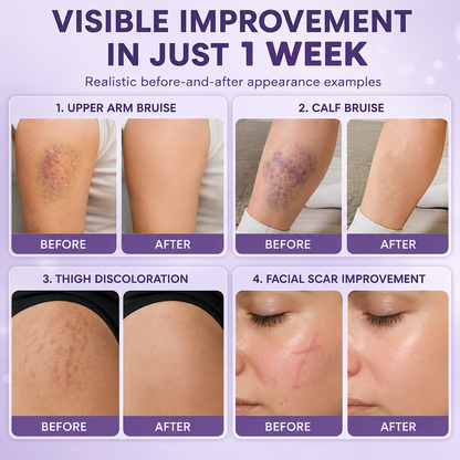 Timilk® BruiseFade Pro Skin Repair Cream
