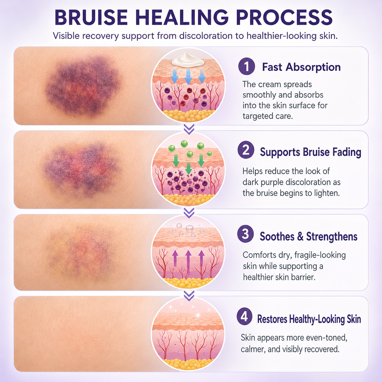 Timilk® BruiseFade Pro Skin Repair Cream